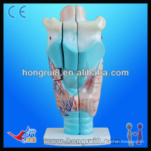 VIVID 3 times enlarged anatomical larynx throat model